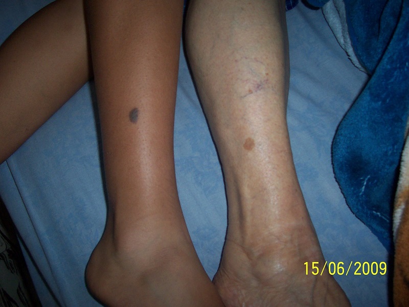 feet